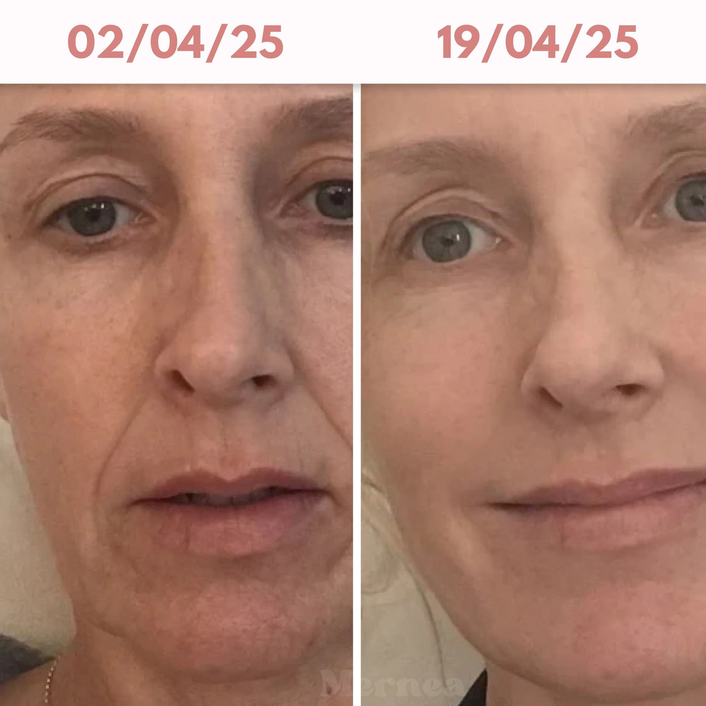 Bio - Collagen Glow Up Mask 2.0