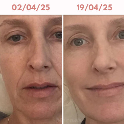 Bio - Collagen Glow Up Mask 2.0