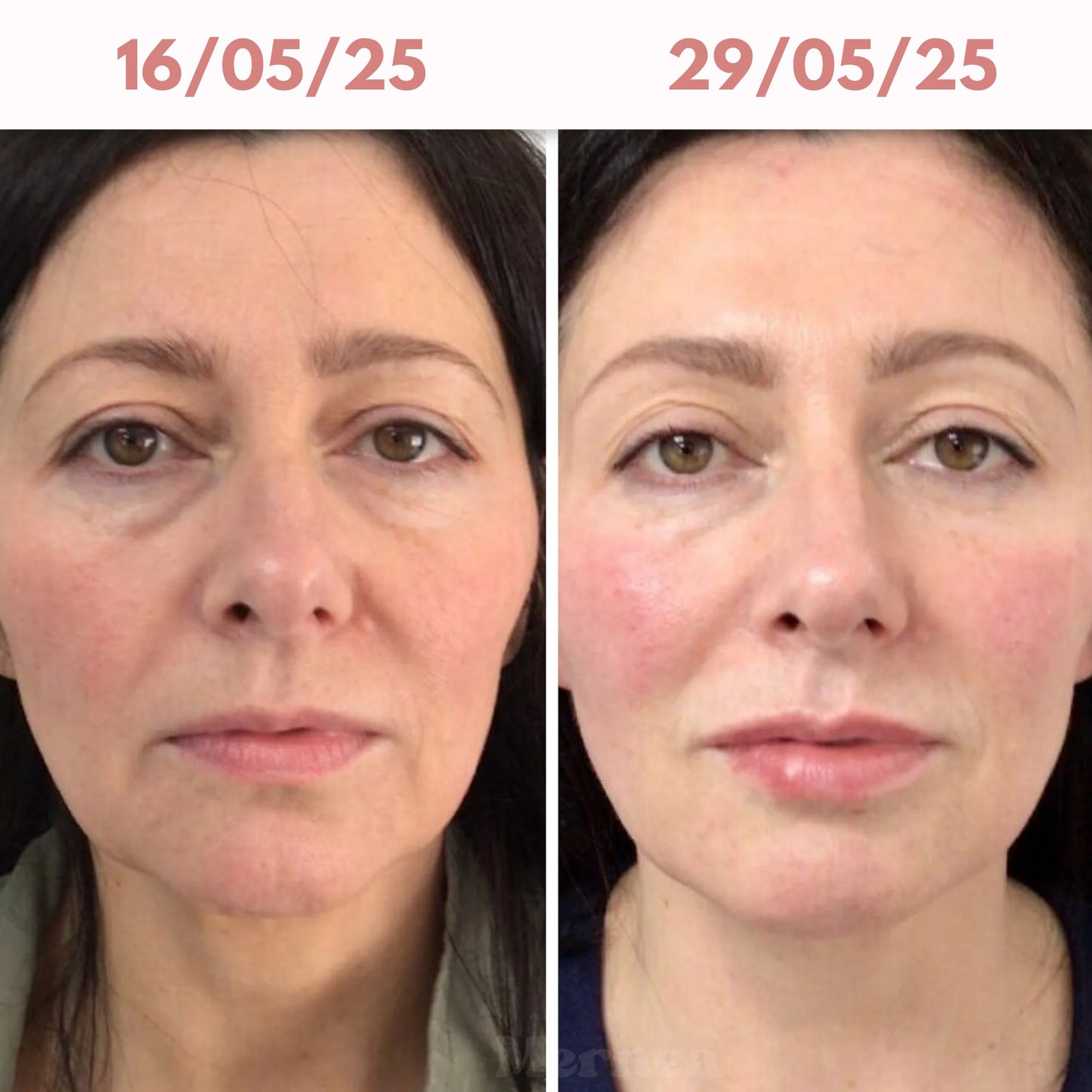 Bio - Collagen Glow Up Mask 2.0